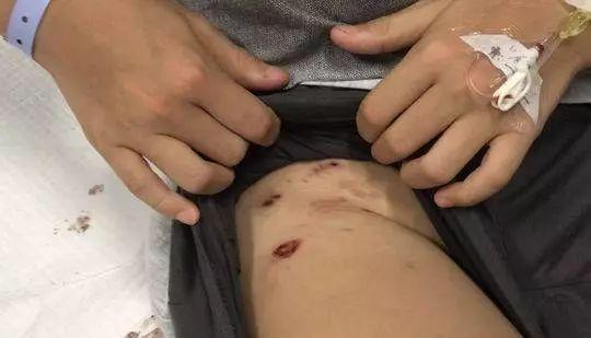 澳门大学研究生申请官网和7岁男孩遭3只犬撕咬与7岁男孩遭3只犬撕咬怎么办